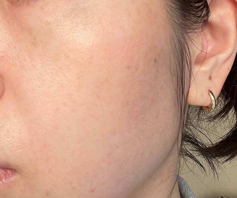 肌のハリや、くすみ