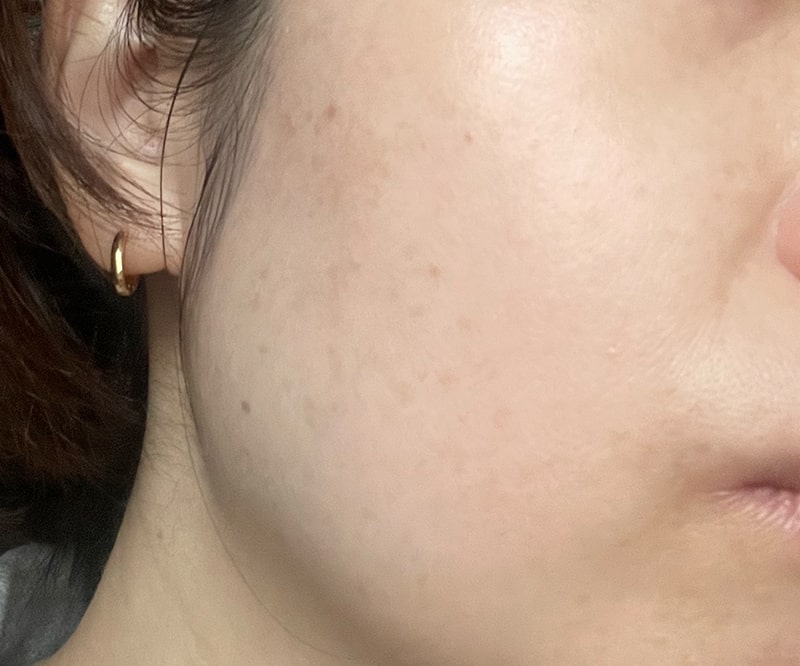 肌のハリや、くすみ