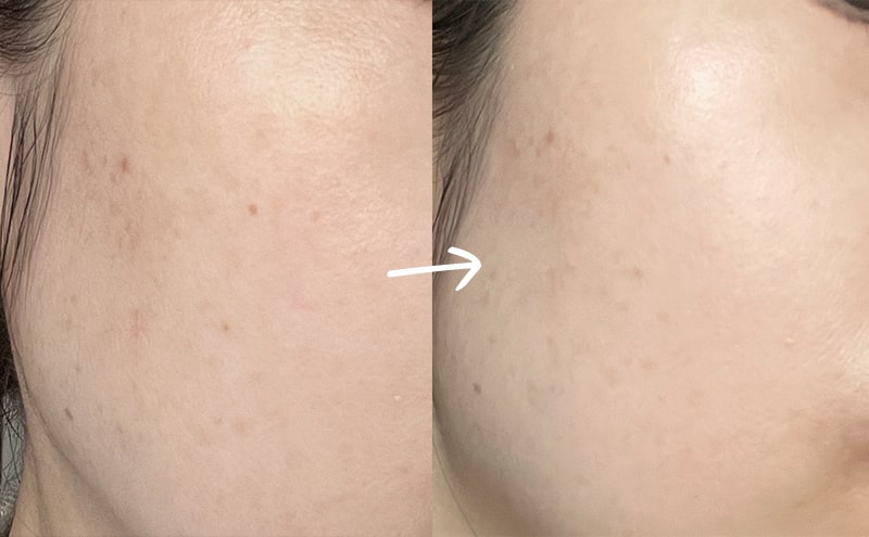 肌のハリや、くすみ