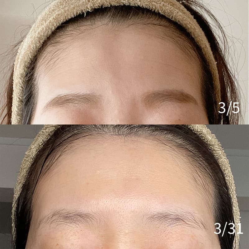 ZIIP HALO 2.0 美顔器